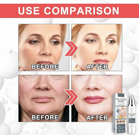 BOTOX STOCK SOLUTION - Serum Antienvejecimiento Facial + ENVÍO GRATIS